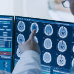 Опыт московских врачей по тестированию искусственного интеллекта лег в основу национального стандарта